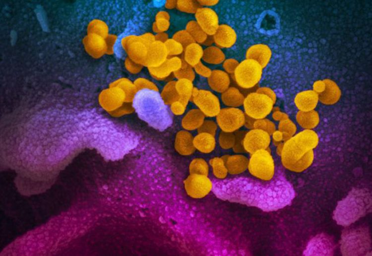 brazil-Coronavirus_kleur-Brazil-750x516