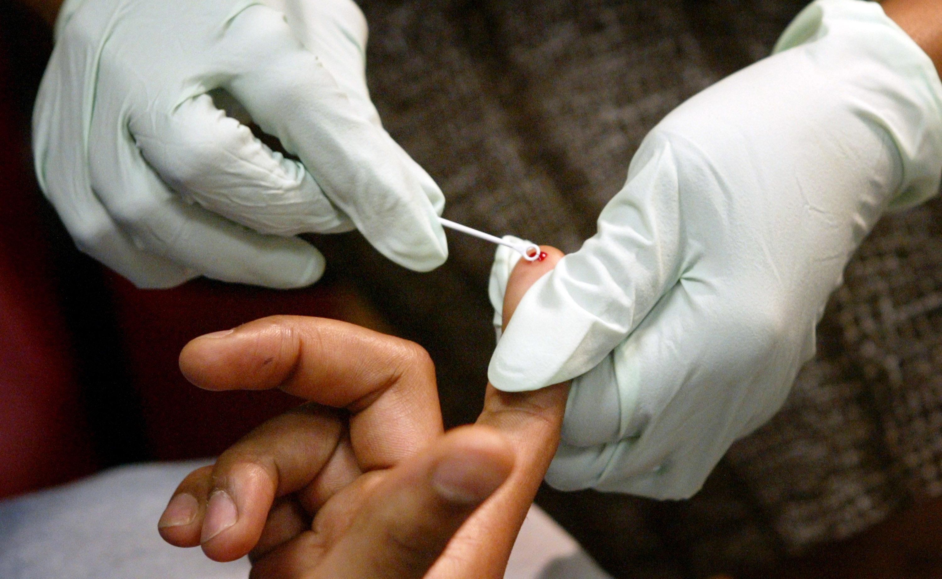 HIV Testing