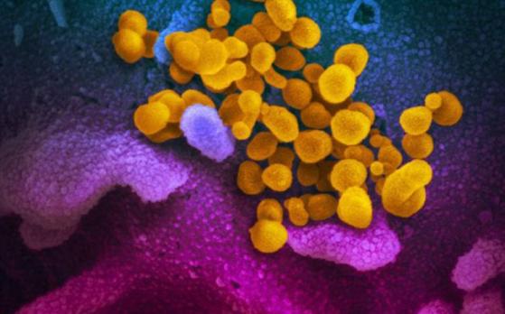 brazil-Coronavirus_kleur-Brazil-750x516