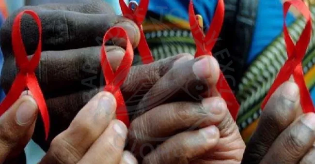 HIV AIDS